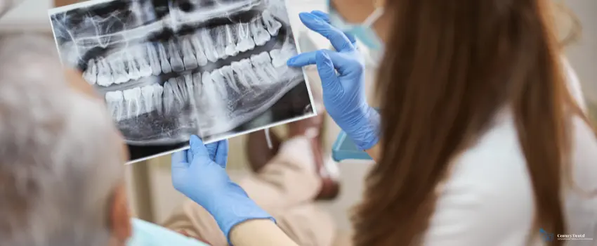 CD-Dentist showing the X-Ray image of patient's teeth