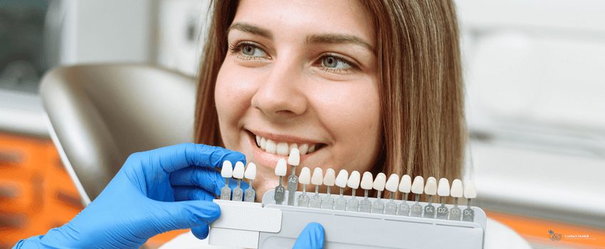 CD-Selection of the correct tooth color for professional cosmetic bleaching at the dentist