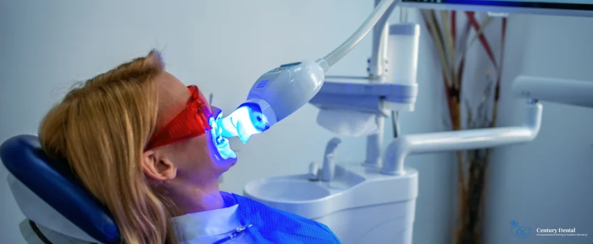 CD-Teeth whitening in dental office
