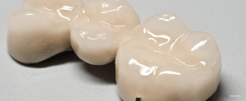 CD-White porcelain dental crown model