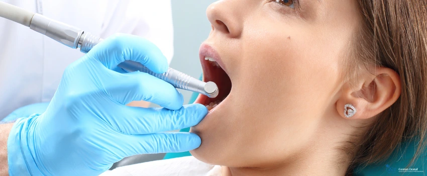 CD-Woman having a root canal treatment