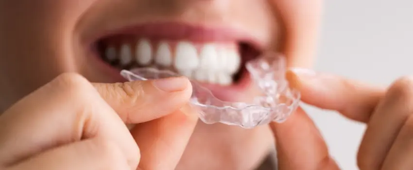 CD-Woman putting her clear aligner