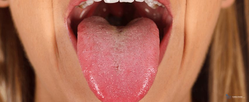CD-Woman`s tongue