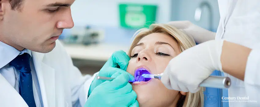 Does Teeth Whitening Work on Fillings