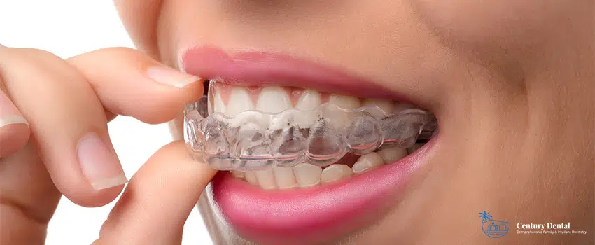 How Strong is Invisalign - Does It Last