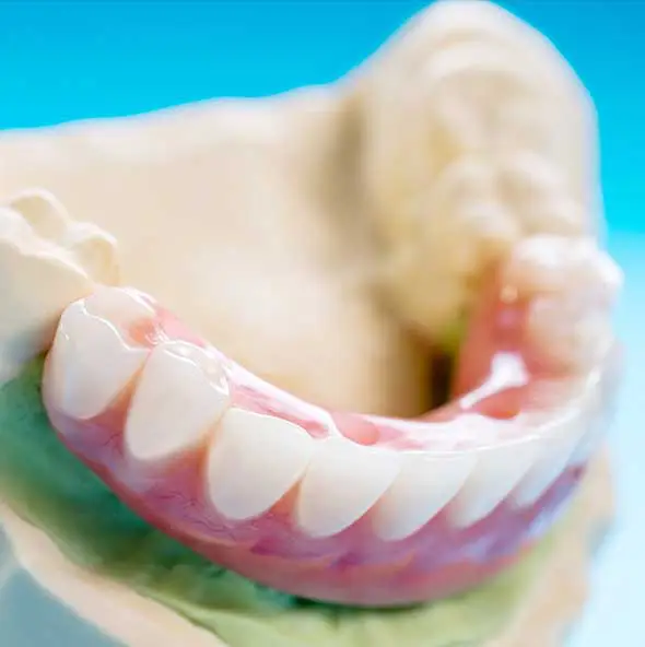 CD deteriorating jawbone century dental south pasadena fl